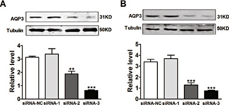 Fig. 1. Effect of siRNA knockdown of Aquaporin 3 (AQP3) on protein expression of AQP3. The A549 and NCI-H460 cells were cultured and transfected with AQP3 siRNA-1 siRNA-2 or siRNA-3. Twenty-four hours after transfection, the protein expression of AQP3 was detected in A549 cells (A) and NCI-H460 cells (B). All of the values are denoted as the mean±SEM; **p < 0.01 or ***p < 0.001 vs. siRNA-NC, n = 3 independent experiments.