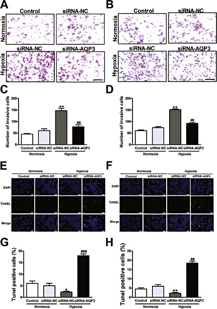 Fig. 4. Effect of AQP3 knockdown on invasion and apoptosis in A549 and NCI-H460 cells. Photographs represent the cells passing through the Matrigel in an invasion assay in A549 (A) and NCI-H460 cells (B). The histogram shows that AQP3 knockdown substantially reduced cell invasion after transfection with the AQP3 siRNA for 24 h in A549 (C) and NCI-H460 cells (D). The TUNEL assay studies show that AQP3 knock-down induced cells apoptosis. The representative images are shown for A549 (E) and NCI-H460 cells (F). Quantitative analysis was performed to document that AQP3 knockdown significantly enhanced the number of apoptotic nuclei in A549 (G) and NCI-H460 cells (H). All of the values are denoted as the mean±SEM; * p < 0.05 or ** p < 0.01 vs. siRNA-NC of normoxia, ## p < 0.01 or ### p < 0.001 vs. siRNA-NC of hypoxia, experiments were repeated six times.