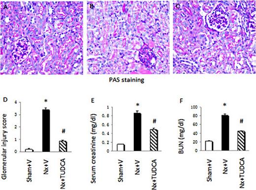 Fig. 1. Physiologic parameters in mice at the end of the 12-week study. Representative photomicrographs (magnification × 400) of PAS-stained kidney sections (A-D). (A) Sham+V group; (B) Nx+V group; (C) Nx+TUDCA group; (D) Glomerular Injury Score; (E) serum creatinine; (F) BUN. Data are the mean ± SEM (n = 6). * P < 0.05, Sham+V vs. Nx+V group; # P < 0.05, Nx+V group vs. Nx+TUDCA group.