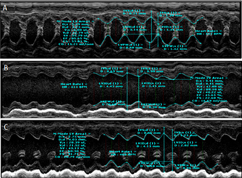 Fig. 2. General characteristics and echocardiography features across all groups. (A) Sham+V group; (B) Nx+V group; (C) Nx+TUDCA group.