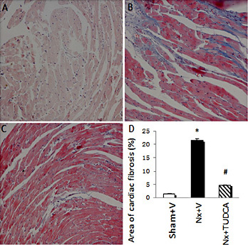 Fig. 3. Collagen content in left-ventricular tissues of mice. Representative photomicrographs of Masson's trichrome-stained heart sections (A-C). (A) Sham+V group; (B) Nx+V group; (C) Nx+TUDCA group; (D) area of cardiac fibrosis (%) was evaluated as described in the Material and Methods section. Values are the mean ± SEM (n = 6). * P < 0.05, Sham+V vs. Nx+V group; # P < 0.05, Nx+V group vs. Nx+TUDCA group. Magnification × 400.