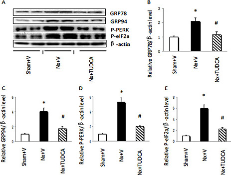 Fig. 6. TUDCA ameliorated uremia-induced ERS in cardiomyocytes. (A) Representative western blots of GRP78, GRP94, P-PERK and P-eIF2a. (B) Relative expression of GRP78 to expression of β-actin. (C) Relative expression of GRP94 to expression of β-actin. (D) Relative expression of P-PERK to expression of β-actin. (E) Relative expression of P-eIF2a to expression of β-actin. Values are the mean ± SEM (n = 6). * P < 0.05, Sham+V vs. Nx+V group; # P < 0.05, Nx+V group vs. Nx+TUDCA group.