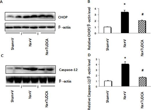 Fig. 7. TUDCA inhibited an ERS-induced apoptotic pathway in cardiomyocytes. (A) Representative western blots of CHOP. (B) Relative expression of CHOP to β-actin expression. (C) Representative western blots of caspase-12. (D) Relative expression of caspase-12 to β-actin expression. Values are the mean ± SEM (n = 6). * P < 0.05, Sham+V vs. Nx+V group; # P < 0.05, Nx+V group vs. Nx+TUDCA group.