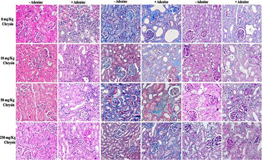 Fig. 6. Morphological changes in the kidney following treatment with chrysin at 0, 10, 50 and 250mg/Kg to rats with (+ Adenine) or without (- Adenine) adenine. (A) hematoxylin and eosin stain used for the identification and semi-quantitative scoring of inflammation. (B) Masson Trichome stain used for identification and semi-quantitative scoring of fibrosis. (C) periodic acid-Schiff stain, used for the identification and semi-quantitative scoring of atrophy of the basal membrane and dilatations.