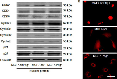 Fig. 3. Pttg1 decreases nuclear p27 levels to increase BC cell proliferation. (A) We examined the nuclear protein levels of all CDKs, Cyclins and cell-cycle inhibitors that had been shown to be involved in the pathogenesis of BC in these Pttg1-modified MCF7 cells by Western blot. We did not find changes in any CDKs, Cyclins and p21 in these Pttg1-modified PC cells, but detected a significant increase in p27 in Pttg1-deprived cells and a significant decrease in p27 in Pttg1-overexpressing cells. (B) Immunocytochemistry for p27 in Pttg1-modified MCF7 cells.