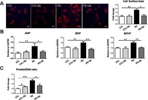 Fig. 2. Qiliqiangxin reverses phenylephrine-induced cardiac hypertrophy. The neonatal rat cardiomyocytes were pretreated with Qiliqiangxin (QL, 0.5 µg/mL, 48 h) followed by treatment with phenylephrine (PE, 50 µmol/L, 48 h). (A) The cell surface of cardiomyocytes was determined using immunolabelling for α-actinin (red) (n = 6). Nucleus was counter stained with DAPI (blue). Scale bar = 100 µm. (B) The mRNA levels of ANP, BNP, and MYH7 were assayed with real-time PCR (n = 6). (C) The protein/DNA ratio was determined to measure the protein synthesis of cardiomyocytes (n = 6). *, P < 0.05; **, P < 0.01; ***, P < 0.001.