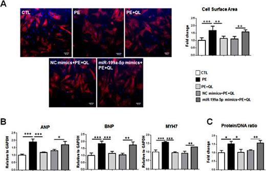 Fig. 4. Overexpression of miR-199a-5p abolishes the anti-hypertrophic effect of Qiliqiangxin on cardiomyocytes. The neonatal rat cardiomyocytes were pretreated with Qiliqiangxin (QL, 0.5 µg/mL, 48 h), and then transfected with miR-199a-5p mimics or negative controls (NC-mimics) for 8 h before phenylephrine (PE) stimulation. (A) The cell surface of cardiomyocytes was determined using immunolabelling for α-actinin (red) (n = 6). Nucleus was counter stained with DAPI (blue). Scale bar = 100 µm. (B) The mRNA levels of ANP, BNP, and MYH7 were assayed with real-time PCR (n = 6). (C) The protein/DNA ratio was determined to measure the protein synthesis of cardiomyocytes (n = 6). *, P < 0.05; **, P < 0.01; ***, P < 0.001.
