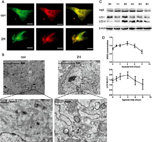 Fig. 1. Hypoxia increases NRVMs autophagy at early stage. (A) Fluorescent microscopy analysis of NRVMs transiently overexpressing mRFP-GFP-LC3, hypoxia for 2h or no hypoxia (scale bar: 5μm). con: control group. (B) Transmission electron microscope detected autophagosomes in NRVMs, hypoxia for 2h. (C) Western blot analysis revealed the change of Atg5, LC3 I and LC3 II at different time points of hypoxia. (D) Protein densitometric quantification of Atg5 and LC3 II/LC3 I ratio. All results are mean±SEM of three independent experiments.
