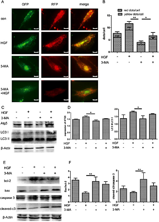 Fig. 5. 3-MA reverses the effect of HGF in increasing NRVMs autophagy and decreasing apoptosis. (A) Fluorescent microscopy analysis of NRVMs transiently overexpressing mRFP-GFP-LC3, HGF (100ng/mL) and/or 3-MA (10mM) were added into NRVMs medium and hypoxia for 2h. (B) Statistic analysis of fluorescent points in NRVMs. (C) Western blot analysis of Atg5, LC3 I and LC3 II. (D) Protein densitometric quantification of Atg5 and LC3 II/LC3 I ratio. (E) Western blot analysis of Bcl-2, Bax, Caspase 3, cleaved-Caspase 3 in NRVMs hypoxia for 4h. (F) Protein densitometric quantification of Bax/Bcl-2 and cleaved-Caspase 3/Caspase 3. *p < 0.05, **p < 0.01. All results are mean±SEM of three independent experiments.