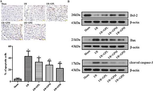 Fig. 3. Pre-administration of GP significantly attenuated apoptosis in vivo. (A) quantitative analysis result and representative images of apoptosis in rat models as illustrated by TUNEL staining (400 × magnification). a, significantly different from sham group, P < 0.05. b, significantly different from I/R group, P < 0.05. Scale bar, 50 µm. (B) effect of GP treatment on the expression of molecules apoptosis in rat models, the reduction in the expression Bcl-2 resulted from I/R injury was increased by pre-treatment of GP while the up-regulation of Bax and cleaved caspase 3 was inhibited by pre-treatment of GP.
