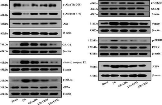 Fig. 4. Effect of GP treatment on the expression of molecules involved in the PI3K/Akt pathway and ER stress in rat models: the reduction in the expression of p-Akts and p-GSK3β resulted from I/R injury was increased by pre-treatment of GP; the up-regulation of GRP78, CHOP, cleaved caspase 12, p-PERK, p-eIF2α, and ATF4, was inhibited by pre-treatment of GP; I/R injury or treatment of GP had no influence on the expression of GSK3β, PERK, or eIF2α.