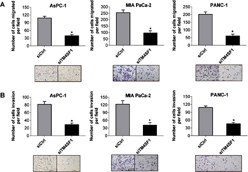 Fig. 3. Pancreatic cancer cell migration and invasion were decreased following transient silencing of TM4SF1. (A) Effect of siRNA silencing of TM4SF1 on the migration of AsPC-1, MIA PaCa-2, and PANC-1 cells. After transiently transfecting cells with siControl or siTM4SF1, cells were added to the upper compartment of a migration or invasion chamber, and the number of cells invading the lower chamber was estimated in eight random fields at ×100 magnification after 24 hours. The rate of migration of cells with transiently silenced TM4SF1 expression was markedly reduced. (B) siRNA silencing of TM4SF1 expression on the invasion of AsPC-1, MIA PaCa-2, and PANC-1 cells. *P < 0.05 versus control.