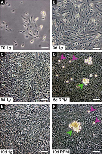 Fig. 1. Morphologic examination of the ARPE-19 cells. Phase-contrast microscopy images of ARPE-19 cells after establishment before start of the experiment (TO) (A), after 3d at 1g (B), and after they have been cultured on the RPM for 5d (D) and 10d (F). Control samples of 5d (C) and 10d (E) formed no MCS. The samples cultured for 5d (D) and 10d (F) on the RPM formed two distinct populations represented by cells that remained adherently as a monolayer or MCS. Generally, the MCS build after 10d (green arrowheads in F) increased in size compared to the MCS formed after 5d (green arrowheads in D). In both cases less-adherent cells, probably representing cells that have the potential to form MCS are observed (purple arrowheads in D and F). Scale bar: 100 µm.