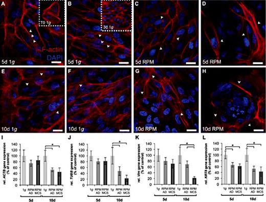 Fig. 2. Cytoskeletal staining of F-actin microfilaments and quantitative alterations of genes of cytoskeletal proteins in ARPE-19 cells exposed to simulated microgravity. (A-H) CLSM after a 5d-exposure (C, D) and a 10d-exposure (G, H) on the RPM and their corresponding 1g-control cells (A, B, E, F). Inserts of 2A and B show freshly established ARPE-19 cells with normal cytoskeleton at T0 (1g) and 3d (1g), respectively. Red staining: TRITC-phalloidin to visualize the F-actin; blue staining: DAPI labeling of nucleus. White arrowheads indicate region of interest. Scale bar: 20 µm. (I-L) Gene expression analyses of cytoskeletal genes assessed by qRT-PCR. After 5d and 10d 1g-control, RPM-adherent (AD) cells, and RPM-multicellular spheroids (MCS) were analyzed for their relative expression levels of (I) ACTB; (J) TUBB; (K) VIM; (L) KRT8 correlated to 18S rRNA. The 5d and 10d 1g-controls were set to 100% * = p < 0.05.