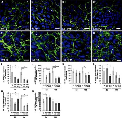 Fig. 3. Cytoskeletal staining of fibronectin and quantitative alterations of extracellular matrix genes in ARPE-19 cells exposed to simulated microgravity. (A-H) CLSM after a 5d-exposure (C, D) and a 10d-exposure (G, H) on the RPM and their corresponding 1g-control cells (A, B, E, F). Green staining: Alexa Fluor 488-conjugated antibodies to visualize fibronectin filaments; blue staining: DAPI labeling of nucleus. White arrowheads indicate region of interest. Scale bar: 20 µm. (I-N) Gene expression analyses of ECM genes assessed by qRT-PCR. After 5d and 10d 1g-control, RPM-adherent (AD) cells and RPM-MCS were analyzed for their relative expression levels of (I) FN1; (J) LAMB2; (K) COL4; (L) ITGB1; (M) ITGB3; (N) TIMP1 correlated 18s rRNA. The 5d and 10d 1g-controls were set to 100% * = p < 0.05.