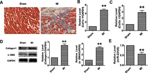 Fig. 1. miR-22 is down-regulated in the border zone of the infarcted region after MI. (A) Masson Trichrome staining of mouse heart sections shows collagen deposition and interstitial fibrosis in the border zone of the infarcted region 7 days after MI. Bothe the mRNA levels of Col1α1 (B) and Col3α1 (C) were up-regulated in the MI mice compared with sham group. (D) Western blot assays showed the increased collagen1 and α-SMA expression in the heart of with MI. (E) Real-time PCR analysis confirms the decreased miR-22 in response to MI compared with sham operated animals. n = 3 ** p < 0.01 vs. sham group.