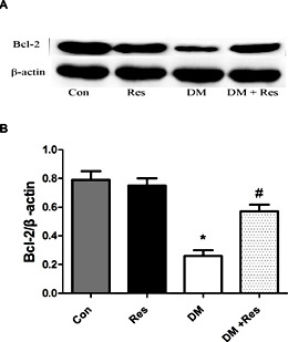 Fig. 2. Western blotting analysis reveals Bcl-2 expression. (A) Bcl-2 and β-actin protein bands. (B) The relative protein expression of Bcl-2. *p<0.05 vs. Con group. #p<0.05 vs. DM group.