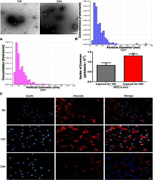 Fig. 3. Characterization of MSC-derived exosomes, and their internalization into H9C2s. (A). Exosomes extracted using the ExoQuick method from the supernatant fluids after incubating MSCs in hypoxic conditions for 12 h or 24 h were examined using TEM. (B). qNano was used to measure the size distribution and concentration of MSC-derived exosomes. (C). The internalization of exosomes into H9C2s was detected by fluorescence microscopy after H9C2s were co-cultured with PKH26-labeled exosomes for 6 h, 12 h and 24 h. Transverse line=100µm. Each bar represents the mean±SD of three independent experiments. *P<0.05 as compared to the control group, and three independent experiments were performed in A and B.
