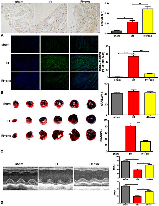 Fig. 7. Autophagy induced by MSC-derived exosomes decreased rat cardiomyocyte apoptosis and the myocardial infarction size as well as improved heart function in vivo. (A). LC3B was detected in myocardial tissue by fluorescence microscopy. ROD was calculated by image pro plus software as the ratio of IOD vs.the measured area. (B). Cardiomyocyte apoptosis in myocardial tissue was measured using the TUNEL assay. The TUNEL staining ratio was calculated as the ratio of apoptotic cardiomyocytes vs. total myocytes. (C). Myocardial infarction size was detected by TTC/Evan blue staining. Blue, red and white stained areas represent viable myocardium, AAR and IS, respectively. AAR/LV and IS/AAR were calculated by image pro plus software. (D). The heart function of rats in the four groups was measured by echocardiography. Each bar represents the mean±SD of four or six independent experiments. Transverse line=100µm. exo=exosomes.*P<0.05; and ***P<0.001 compared to the control group.