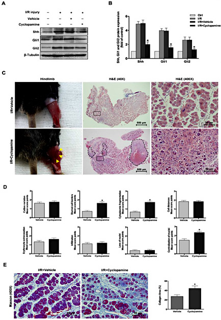 Fig. 2. Inhibition of Shh aggravated skeletal muscle destruction and fibrosis in response to I/R injury. (A and B) In muscle, 7 days after I/R injury, the protein expression of Shh, Gli1 and Gli2 in the cyclopamine treatment group, vehicle treatment group and untreated group was estimated by western blotting; muscle from the uninjured contralateral limb served as the control group. n=3/group. (C) Representative image and H&E staining of a muscle 7 days post-I/R injury treated with cyclopamine in comparison with the vehicle treatment group. (C left, infarct areas were marked with yellow arrows; C middle, magnification = ×40, infarct areas are marked with black dashed line, Scale bars, 500 µm; C right, magnification = ×400, Scale bars, 50 µm). n=5/group. (D) Destruction scores from H&E staining were used to estimate the level of skeletal muscle damage. (E) Representative images of Masson’s trichrome staining of skeletal muscle in cyclopamine-treated and vehicle-treated groups. The collagen area, determined by quantification of the blue staining area, was used to evaluate the fibrotic tissue. Fiji Image J software was used to quantify the percentage of the collagen area. n=3/group. All data are presented as the mean ± SEM; * indicates a statistically significant difference between the cyclopamine treatment group and the vehicle treatment group (p < 0.05).