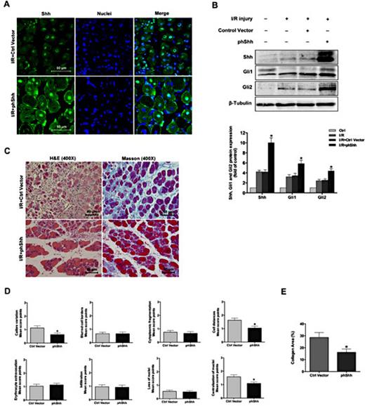 Fig. 3. Effects of phShh treatment on skeletal muscle destruction and fibrosis in response to I/R injury. (A) Skeletal muscle was treated with phShh after ischemic injury, and immunofluorescence staining for Shh (green) was performed on cross sections of phShh-treated and control vector-treated skeletal muscle 7 days after I/R injury; nuclei were labeled with DAPI (blue). Scale bars, 50 µm. n=5/group. (B) Western blotting was performed to estimate the protein expression of Shh, Gli1 and Gli2 in phShh-treated, control vector-treated and untreated skeletal muscle 7 days after I/R injury. Muscle from the uninjured contralateral limb served as the control group. n=3/group. (C) H&E staining and Masson’s trichrome staining were performed on muscle sections from the phShh treatment group and the control vector treatment group 7 days after I/R injury (C left, H&E staining, magnification = ×400; C right, Masson’s trichrome staining, magnification = ×400. Scale bars, 50 µm). n=3/group. (D) Destruction scores determined by H&E staining of skeletal muscle were used to estimate the degree of muscle damage. (F) The collagen area, based on Masson’s trichrome staining, was used to evaluate the fibrotic tissue and was determined by quantification of the blue staining area. Fiji ImageJ software was used to quantify the percentage of collagen area. All data are presented as the mean ± SEM; * indicates a statistically significant difference between the phShh treatment group and the control vector treatment group (p < 0.05).