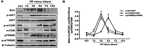Fig. 4. Shh activation combined with AKT/mTOR/p70S6K signaling up-regulation following skeletal muscle I/R injury. (A) Western blotting was used to estimate the protein expression of Shh, the phosphorylation and total protein expression of AKT, mTOR, and p70S6K after 3 hours of unilateral hindlimb ischemia and 1, 3, 5, 7, or 14 days of reperfusion; muscle from the uninjured contralateral limb served as the control. (B) Densitometry was used to quantify the immunoblot images, and the results are shown as the ratio of p-AKT to total AKT, p-mTOR to total mTOR and p-p70S6K to total p70S6K. n=3/group. All data are presented as the mean ± SEM; * indicates a statistically significant difference between the I/R group and the control group (p < 0.05).