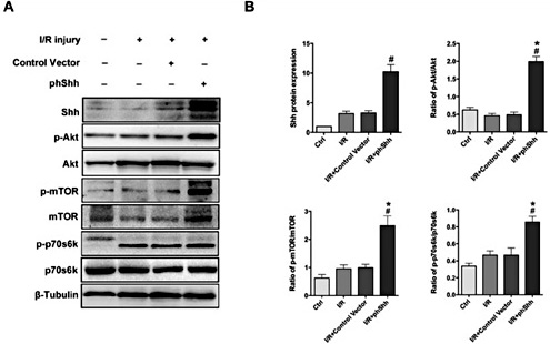 Fig. 5. phShh treatment increased AKT/mTOR/p70S6K signaling following skeletal muscle I/R injury. (A) Skeletal muscle was treated with phShh after ischemic injury, and then, western blotting was used to estimate the protein expression of Shh, the phosphorylation and total protein expression of AKT, mTOR, and p70S6K in phShh-treated, control vector-treated, and untreated skeletal muscle 7 days after I/R injury. Muscle from the uninjured contralateral limb served as an internal control. (B) Densitometry was used to quantify the immunoblot images, and the results are shown as the expression of Shh and the ratio of p-AKT to total AKT, p-mTOR to total mTOR and p-p70S6K to total p70S6K. n=3/group. All data are presented as the mean ± SEM; * indicates a statistically significant difference between the phShh treatment group and the control vector treatment group, # indicates a statistically significant difference between the I/R group and the control vector group (p < 0.05).