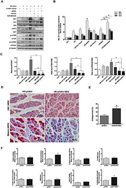 Fig. 6. The protective effects of phShh treatment were abrogated by inhibition of the AKT/mTOR/p70S6K pathway. (A, B and C) phShh treatment was used to over-express the Shh pathway, and NVP-BEZ235 was used to inhibit the AKT/mTOR/p70S6K pathway. Subsequently, in muscle 7 days after I/R injury, western blotting was used to estimate the expression of Shh, Gli1 and Gli2 and the phosphorylation and total protein expression of AKT, mTOR, and p70S6K in the control vector treatment, phShh treatment, vehicle treatment, NVP-BEZ235 treatment, phShh+NVP-BEZ235 treatment and untreated groups. Muscle from the uninjured contralateral limb served as the control group. Densitometry was used to quantify the immunoblot images. n=3/group. (D) H&E staining and Masson’s trichrome staining were performed on muscle sections from the phShh treatment group and phShh+NVP-BEZ235 treatment group 7 days after I/R injury (D top, H&E staining, magnification = ×400; D Bottom, Masson’s trichrome staining, magnification = ×400. Scale bars, 50 µm). n=3/group. (E) The collagen area, based on Masson’s trichrome staining, was used for evaluation of the fibrotic tissue and was determined by quantification of the blue staining area. Fiji ImageJ software was used to quantify the percentage of collagen area. (F) The destruction scores of skeletal muscle, determined by H&E staining, were used to estimate the degree of muscle damage. All data are presented as the mean ± SEM; * indicates a statistically significant difference; # indicates a statistically significant difference between each I/R group and the control group (p < 0.05).