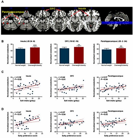 Fig. 4. Brain regional metabolism changes in response to high salt intake in overweight/obesity. (A) The brain regions exhibiting higher activity in response to high salt. The images depict two sample t-test for the overweight/obesity group (n=15) vs. the normal weight group (n=17). The significance threshold was set at a P<0.005, and SPM{t} maps were superimposed on a standard magnetic resonance imaging brain template. (B) Comparison of normalized glucose metabolism in the insula, OFC, and parahippocampus between the normal weight (n=17) and overweight/obesity groups (n=15). The peak coordinates of each VOI are shown in parentheses. ** P<0.01, *** P<0.001 vs. normal weight. Linear regression analysis of the relationship of normalized glucose metabolism in the insula (left) /OFC (middle) / parahippocampus (right) with individual salt intake (C) and salty preference scores (D). The solid line corresponds to the regression line, and the dashed line represents the 95% confidence band of the best-fit line.
