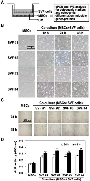 Fig. 1. Experimental scheme of our study (A). Time-dependent morphological changes (B) and ALP staining (C) and ALP activity (D) of MSCs co-cultured with SVF cells. The data are representative of three independent experiments. Significant differences among the co-culture groups and the mono-culture group were determined via ANOVA, with p values indicated as *p<0.001 and **p<0.0001.