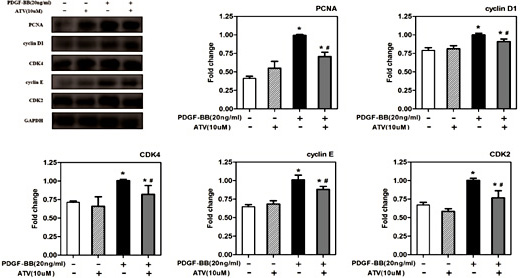 Fig. 3. The effect of atorvastatin calcium on cell cycle regulatory protein expression. After 24h of starvation with serum-free DMEM, VSMCs were incubated with 20ng/mL PDGF-ββ with or without ATV for 24h. The protein expression levels of PCNA, cyclin D1, CDK4, cyclin E and CDK2 were determined by western blotting. GAPDH, glyceraldehyde 3-phosphate dehydrogenase. The band intensity was quantified using ImageJ 1.47 software and relative expression averaged across the three experiments. Probability values are indicated above bars: ∗P< 0.05 compared with nonstimulated controls; #P< 0.05 compared with 20ng/mL PDGF-BB-induced controls.