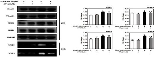 Fig. 5. Atorvastatin calcium inhibits migration-related proteins expression and VSMCs migration induced by PDGF-ββ. After 24h of starvation with serum-free DMEM, VSMCs were incubated with 20ng/mL PDGF-ββ with or without ATV for 24h. The protein expression levels of ICAM-1, VCAM-1, MMP-2, and MMP-9 were determined by western blotting, and the enzymatic activities of MMP-2 and MMP-9 in the conditioned medium were measured by gelatin zymography assay. The band intensity was quantified using ImageJ 1.47 software and relative expression averaged across the three experiments. *P< 0.05 compared with nonstimulated controls; #P< 0.05 compared with 20ng/mL PDGF-ββ-treated controls. WB, Western blot; Zym, Zymograph.