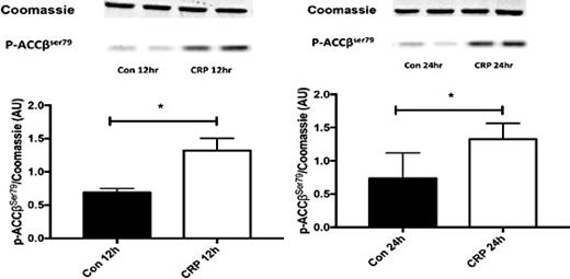 Fig. 4. Phosphorylated acetyl-CoA carboxylase (ACC-β) in human myotubes exposed to CRP for 12h and 24 h. Data are means (bars represent SEM). * p<0.05.