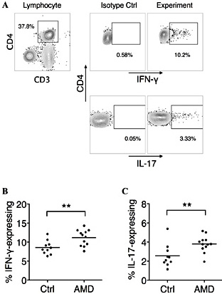 Fig. 1. The percentage of circulating Th1 and Th17 cells was significantly upregulated in AMD patients. PBMCs were stimulated with anti-human CD3/CD28 for 5 h in the presence of brefeldin A. The frequencies of IFN-γ+ and IL-17+ T cells were examined by intracellular staining. (A) The gating strategy of IFN-γ+ and IL-17+ cells in CD4+ T cells, in one representative AMD individual. The IFN-γ+ and IL-17+ gates were drawn according to negative gates set by isotype control antibodies. (B) The frequency of IFN-γ+ CD4+ T cells in healthy control (Ctrl) individuals and AMD individuals. Welch’s t test. **P<0.01. (C) The frequency of IL-17+ CD4+ T cells in healthy control (Ctrl) individuals and AMD individuals. Welch’s t test. *P<0.05.