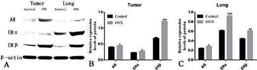 Fig. 4. Relative protein expression levels of AR, ERα and ERβ in transplanted tumour and lung tissues from the two groups. A, B, C. The protein expression levels were higher in the ovariectomized group than in the control group, especially for ERβ in transplanted tumour tissue and ERα in lung tissue. Control: mice treated with partial bilateral fat pad removal near the ovary; OVX: ovariectomized, mice treated with bilateral ovary resection; *P<0.05, **P<0.01, ***P<0.001.