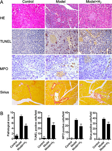 Fig. 2. Hydrogen protected against chronic pancreatitis in mice by histological examination. (A) Tissue inflammation, damage and fibrosis were analyzed on HE (magnification ×200), TUNEL, MPO (magnification ×400), and Sirius staining (magnification ×100). (B) Quantification of (A) **P<0.01 compared with model group.