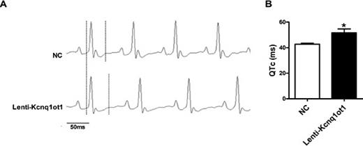 Fig. 6. Prolongation of corrected QT (QTc) upon knockdown of Kcnq1ot1 by lentivirus-shRNA in mice. (A) Representative electrocardiogram. (B) lncRNA Kcnq1ot1 knockdown prolonged QTc in mice. *P<0.05 versus NC; n = 5.