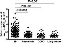 Fig. 7. The qRT-PCR assay validation of hsa_circRNA_001937 expression levels in PBMCs from 115 TB patients versus 40 pneumonia, 40 COPD or 40 lung cancer patients. A one-way ANOVA test was used for statistical analysis. COPD: chronic obstructive pulmonary disease.
