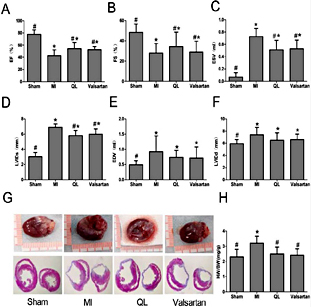 Fig. 1. Qiliqiangxin improved cardiac structure and function. A-H. Densitometric analysis of the data demonstrated a significantly improvement of cardiac function, including preserving left ventricular fractional shortening (FS) and left ventricular ejection fraction (EF) in QL treatment group. G-H. Treatment with QL prevented reversed heart enlargement.* p< 0.05 vs sham. #p< 0.05 vs MI.