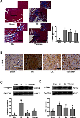 Fig. 2. Qiliqiangxin attenuated cardiac fibrosis. A. Masson’s modified trichrome histology shows that treatment with QL markedly reduced the ratio of area with collagen accumulation to total LV area in MI rats at 8 weeks. Scale bar 50 µm. B. Representative immunohistochemical images show that treatment with QL attenuated α-SMA expression. Scale bar 100 µm. C. Representative immunoblot and densitometric data show that treatment with QL attenuated collagen I level. D. Representative immunoblot and densitometric data show that treatment with QL attenuated α-SMA level. * p< 0.05 vs sham. #p< 0.05 vs MI.