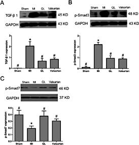 Fig. 3. Qiliqiangxin suppressed cardiac TGF-β1/Smad3 signaling pathway. A. Representative immunoblot and densitometric data show that treatment with QL markedly attenuated TGF-β1 expression in MI rats at 8 weeks. B. Representative immunoblot and densitometric data show that treatment with QL markedly attenuated p-Smad3 expression in MI rats at 8 weeks. C. Representative immunoblot and densitometric data show that treatment with QL markedly increased p-Smad7 expression in MI rats at 8 weeks. * p< 0.05 vs sham. #p< 0.05 vs MI.