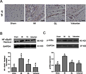 Fig. 5. Qiliqiangxin suppressed cardiac NF-κB signaling pathway. A. Representative immunohistochemical images show that treatment with QL attenuated NF-κB expression. Scale bar 100 µm. B. Representative immunoblot and densitometric data show that treatment with QL markedly attenuated NF-κB expression in MI rats at 8 weeks. C. Representative immunoblot and densitomitric data show that treatment with QL markedly attenuated p-IκBα expression in MI rats at 8 weeks. * p< 0.05 vs sham. #p< 0.05 vs MI.