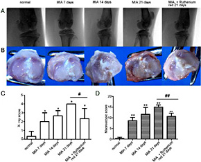 Fig. 2. Macroscopic and radiographic analyses and effect of the TRPV5 inhibitor (Ruthenium red) in the MIA-induced rat OA model. Flowchart representing the groups of experimental animals (A) Macroscopic photographs of tibial plateaus of the rat knee joints (B) X-ray photographs of the total knee joints (C) Radiographic scores measuring joint destruction (D) Macroscopic scores measuring joint destruction. Data are presented as mean ± SEM (n = 3). *P<0.05 vs. untreated control; #P<0.05 between MIA 21 day and MIA + ruthenium red 21 day treatment groups; **P<0.05 vs. untreated control; ##P<0.05 between MIA 21 day and MIA + ruthenium red 21 day groups. MIA, monosodium iodoacetate.