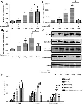 Fig. 3. TRPV5 expression is upregulated in the articular cartilage of MIA-induced OA and, which positively correlates with protein expression of calmodulin and the apoptosis related protein cleaved caspase-8 in OA articular cartilage. (A) Reverse transcription polymerase chain reaction (RT–PCR) showing the level of TRPV5 mRNA in OA from different MIA-stimulated groups. *P<0.05 vs. untreated control, #P > 0.05 between MIA 21 day and MIA + ruthenium red 21 day treatment groups; (B) RT–PCR showing the level of calmodulin mRNA in OA from different stimulated groups. *P<0.05 vs. untreated control; #P<0.05 between MIA 21 day and MIA + ruthenium red 21 day treatment groups. (C) RT–PCR showing the level of cleaved caspase-8 mRNA in OA from different stimulated groups as compared to the normal group. *P<0.05 vs. untreated control, #P<0.05 between MIA 21 day and MIA + ruthenium red 21 day treatment groups. (D) TRPV5, calmodulin, cleaved caspase-8 protein expression from different stimulated groups at each time point as detected by western blotting. (E) A bar graph showing the levels of TRPV5, calmodulin and cleaved caspase-8 proteins in various treatment groups. *P<0.05, **P<0.05, ***P<0.05 vs. untreated control, #P >0.05, ##P<0.05, ###P<0.05 between MIA 21 day and the MIA + ruthenium red 21 day treatment groups.
