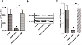 Fig. 6. TRPV5 knockdown identification in rat primary chondrocytes. (A) Real-time polymerase chain reaction (RT–PCR) showed reduced TRPV5 mRNA levels in the TRPV5 siRNA group as compared to the normal group, *P<0.05; as compared to the TRPV5 scrambled siRNA group, **P<0.05. (b) Western blotting shows reduced TRPV5 protein expression in the TRPV5 siRNA group. (C) A bar graph shows the level of reduced level of TRPV5 protein in the TRPV5 siRNA group as compared to the normal group, #P<0.05; and as compared to the TRPV5 scrambled siRNA group, ##P<0.05.