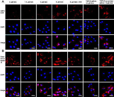 Fig. 7. Calmodulin expression and Cleaved caspase-8 in different chondrocyte treatment groups. Expression of (A) calmodulin (red) and (B) cleaved caspase-8 (red) was determined by immunofluorescence staining (original magnification ×200). MIA, monosodium iodoacetate; RR, ruthenium red; DAPI, blue nuclear stain.