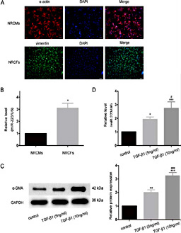 Fig. 1. miR-223 is increased in activated CFs. (A) Identifications of neonatal rat cardiomyocytes (NRCMs) and neonatal rat cardiac fibroblasts (NRCFs). a-actin, the marker of NRCMs, was detected by immunofluorescence using anti-a-actin antibody, Alexa Fluor 594–conjugated goat anti-mouse secondary antibody (red staining), and DAPI for the nuclei (blue). Vimentin, the marker of NRCFs, was detected by immunofluorescence using anti-vimentin antibody, FITC-conjugated goat anti-mouse secondary antibody (green staining), and DAPI for nuclei (blue). Undur 100x microscope. Scale bar: 100µm. (B) Expression of miR-223 in NRCFs compared to NRCMs, n=3. *P< 0.05 versus NRCMs. (C) CFs were stimulated with TGF-β1 with different concentrations (0, 5, 10ng/ml) for 48 hours. Relative α-SMA protein levels were quantified and shown as the mean ± SD, n=3. **P< 0.01, ***P< 0.001 versus control. ###P< 0.001 versus TGF-β1 (5ng/ml). (D) Expression of miR-223 in CFs stimulated with TGF-β1 with different concentrations for 24 hours, n=3. *P< 0.01, ***P< 0.001 versus control. #P< 0.001 versus TGF-β1 (5ng/ml).