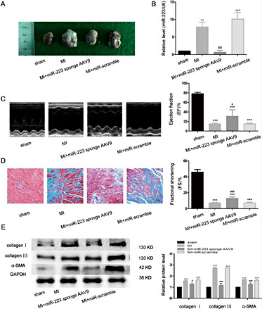 Fig. 7. MiR-223 inhibition in vivo attenuates cardiac fibrosis and improves ventricular function post-MI. The LAD coronary artery of rats were ligated to build up MI models. To downregulate the expression of miR-223 in MI models, miR-223 sponge or miR-scramble mediated by AAV9 were injected intramyocardially before LAD ligation. After 8 weeks, the rats were sacrificed and the following assays were conducted. (A) Appearances of the hearts in each group. (B) qRT-PCR analysis of miR-223 expression in rat myocardial tissues, n=3. (C) Functional and quantitative echocardiographic analysis of the left ventricle. The EF and FS are shown, n=6. (D) Masson’s trichrome staining of rat heart tissue sections showing interstitial fibrosis in the border zones of the infarcted regions, n=6. (E) Representative western blotting results and quantitative data, n=6. *P< 0.05, **P< 0.01, ***P< 0.001 versus sham, #P< 0.05, ##P< 0.05, ###P< 0.001 versus MI.