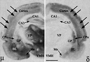 Fig. 1. Differential distribution of MOR (left) and DOR (right) in the rat rostral brain. BL, basolateral amygdaloid nucleus; CA1, field CA1 of hippocampus; CA3, field CA3 of hippocampus; CPu, caudate putamen; GP, globuspallidus; Me, medial amygdaloid nucleus; VMH, ventromedial hypothalamic nucleus; VP, ventral posterior thalamic nucleus. Note that the distributional patterns of MOR and DOR are totally different with MOR having a high density in all major regions including subcortical areas and DOR having a much higher density in the cortex, caudate putamen and amygdala than most of the subcortical regions. Also note that there is a higher density of MOR in the middle layer than the outer and inner layers of the cortex, while the opposite is true for the density of DOR. The other cortical layers have an opposite pattern of expression. Scale bar = 2 mm. Cited from Xia and Haddad [21].
