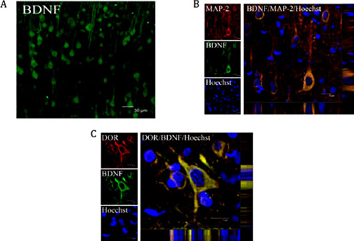 Fig. 2. Co-localization of BDNF and DOR in cortical neurons. Top panel, Fluorescent micrographs of cortical BDNF positive cells. Bar = 30 µm. Middle panel, Fluorescent micrographs of cortical BDNF/MAP-2 double-labeled positive cells. Bar = 15 µm. Bottom panel, Fluorescent micrographs of cortical BDNF/DOR double-labeled positive cells. Bar = 15 µm. Cited from Tian et al. [110].
